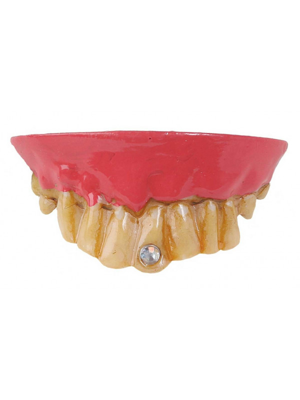 Dentadura con diamante