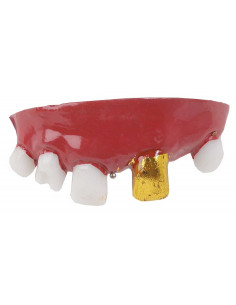 Dentadura con diente de oro