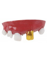Dentadura con diente de oro